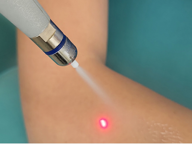 Autors: Publicitātes foto