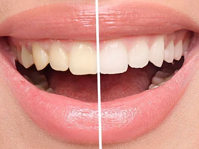 Autors: Publicitātes foto