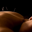 private practice in acupuncture