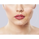 Perform a dermatoscopy