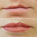 Micropigmentation center