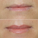 Micropigmentation center