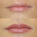 Micropigmentation center