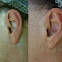 Micropigmentation center