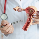 A clear and understandable explanation of the female reproductive system, health changes and treatment options, promoting patient understanding and participation in the treatment process.