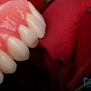 Removable plastic prostheses and their repertoire