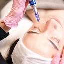 Alexandrite laser hair removal