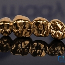 Golden, with gold plating, nitrided crowns