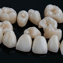 Pressed ceramic crowns