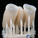 3D printed temporary crowns