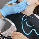 Oral hygiene and prevention