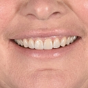 Dental prosthetics in Rezekne