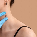 Skin formation( moles) professional evaluation of the neck area at a dermatologist's office.
