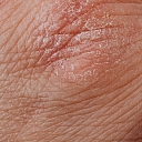 Examination of skin diseases