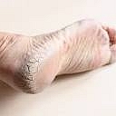 Foot skin treatment