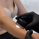 Anti-age procedures