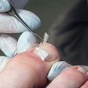 Tamponade or correction with clamps