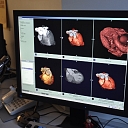 Diagnostics