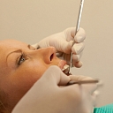 Teeth whitening