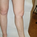 Venous diagnostics treatment operations in Riga Vidzeme