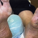 Podiatrist in Jēkabpils