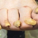 Podiatrist in Jēkabpils region