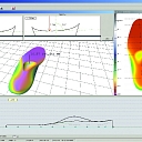 Individually modeled insoles
