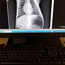 X-ray