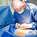 Gynaecological surgeries