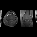 MRI Tells