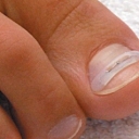 nail trimming