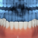 dental treatment