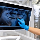 Zobārstniecības prakse Elise NB SIA Liepājā piedāvā mūsdienīgas ārstēšanas metodes, kas atbilst visām kvalitātes prasībām.