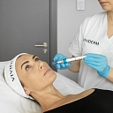 Fractional mesotherapy
