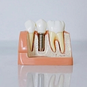 Surgery and implantology