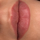 Permanent lip makeup healed