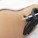 Lipolytic injections