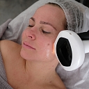 Innovative device procedure for facial skin rejuvenation and improvement. The procedure is painless, effective and suitable for solving various skin problems, promoting skin radiance and elasticity.