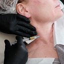Targeted aesthetic procedure for the neck area, which helps improve skin texture, tone and general appearance. An individual approach to each patient guarantees a harmonious and balanced result.