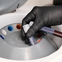 Accurate and sterile blood sample processing, which is essential for providing high-quality aesthetic and restorative procedures.