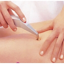 Skin photo rejuvenation