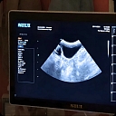 Ultrasound examination of an animal