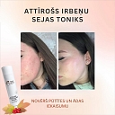 Attīrošs irbeņu sejas toniks