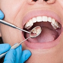 Evaluation of the oral cavity