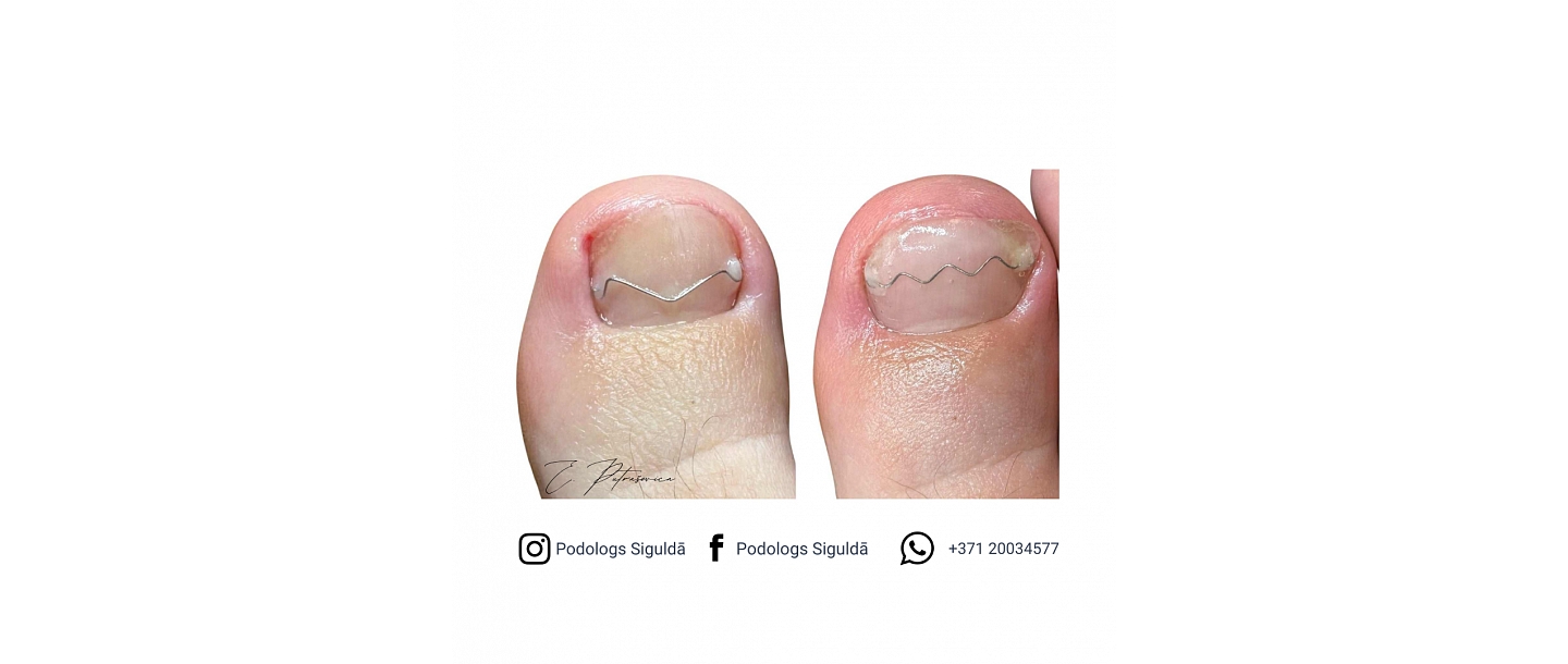 Putraševica Elīna - Podiatrist practice 