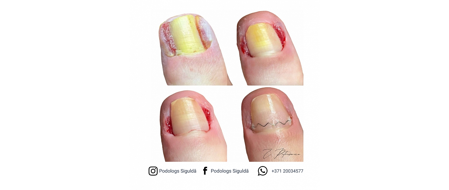 Putraševica Elīna - Podiatrist practice 