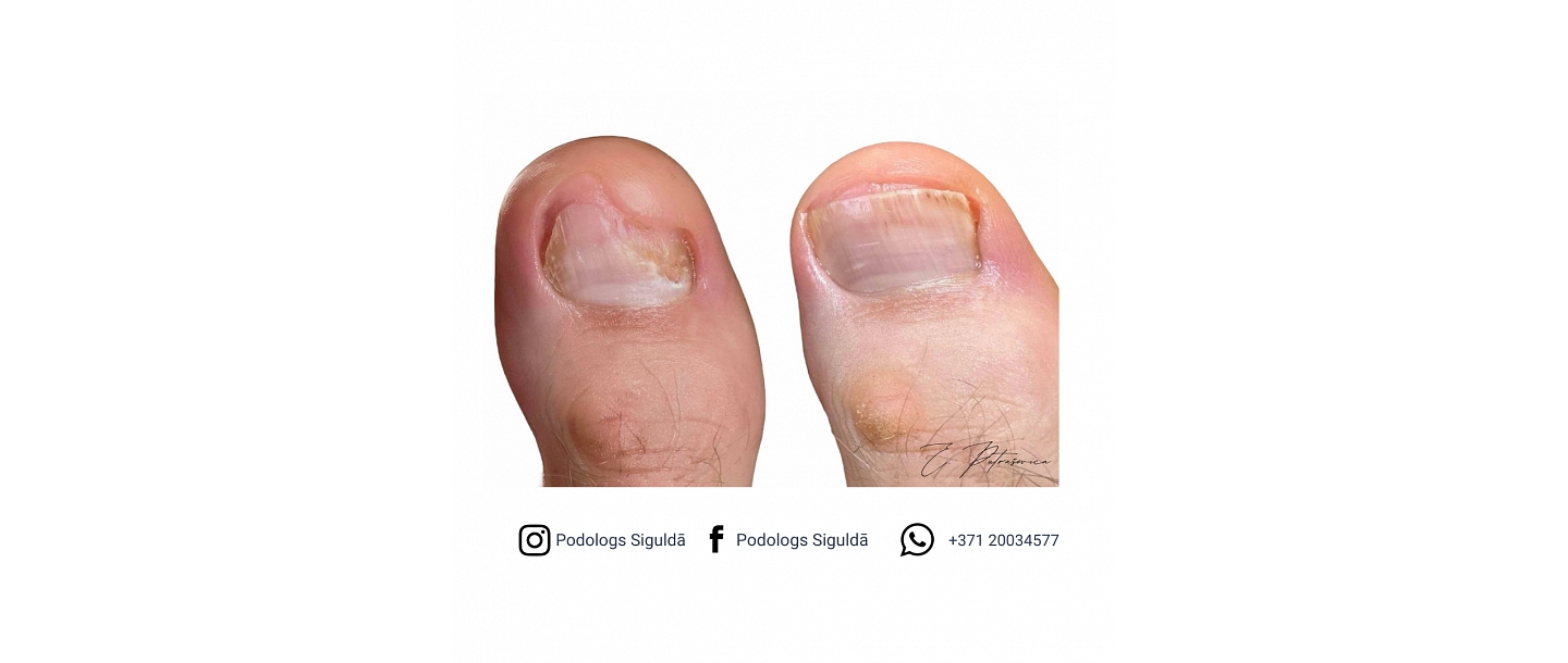 Putraševica Elīna - Podiatrist practice 