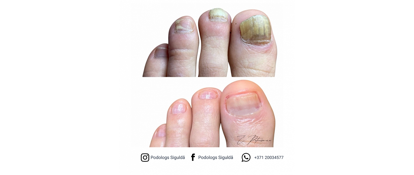Putraševica Elīna - Podiatrist practice 