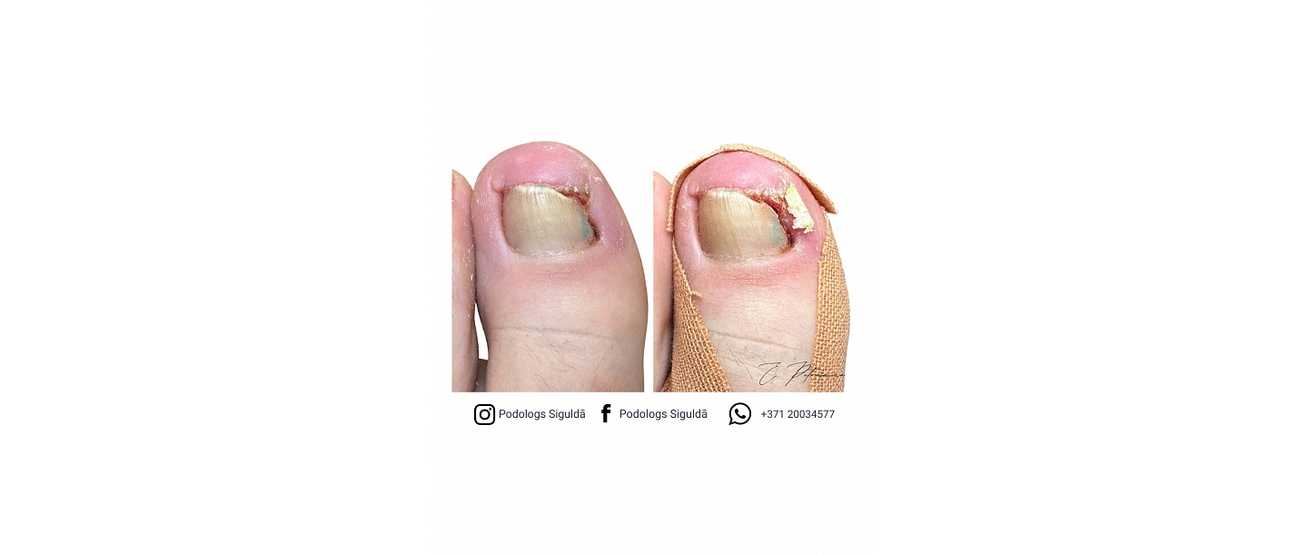 Putraševica Elīna - Podiatrist practice 