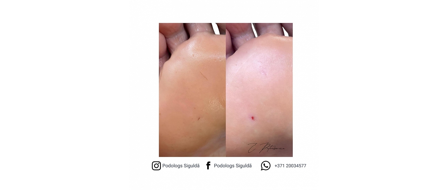 Putraševica Elīna - Podiatrist practice 